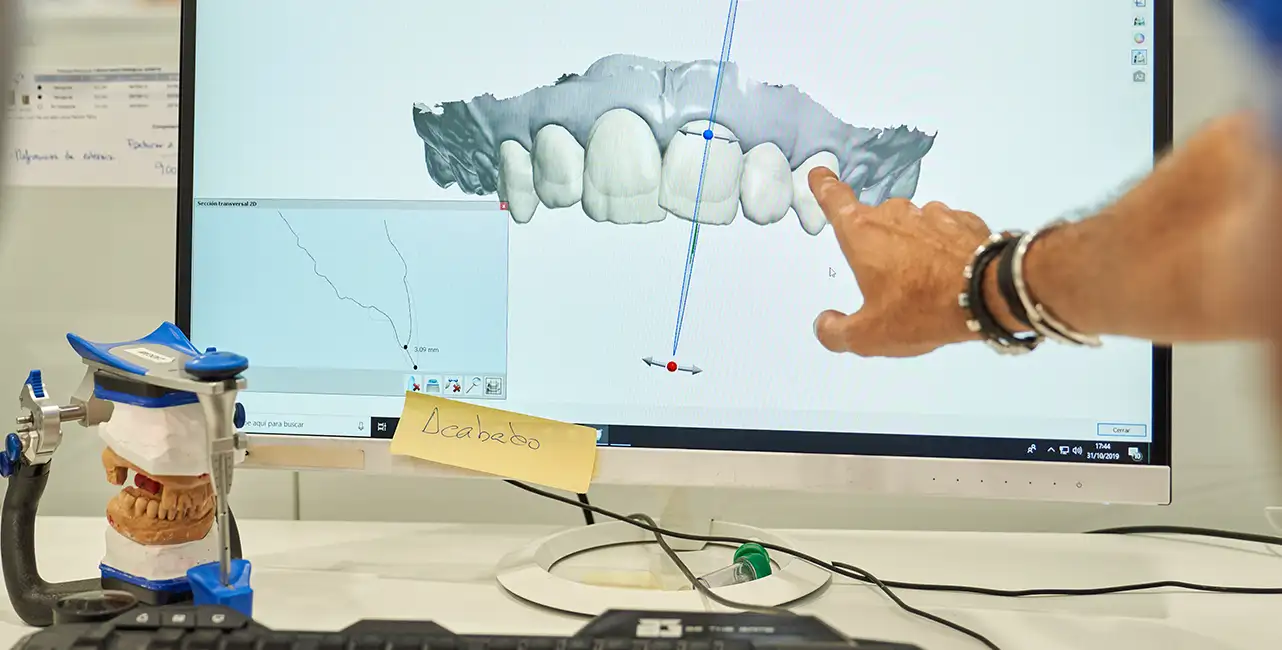 ЦИФРОВОЕ ИЗМЕРЕНИЕ