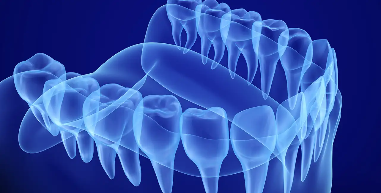 РЕСТАВРАЦИОННАЯ СТОМАТОЛОГИЯ